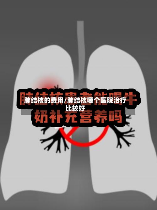 肺结核的费用/肺结核哪个医院治疗比较好